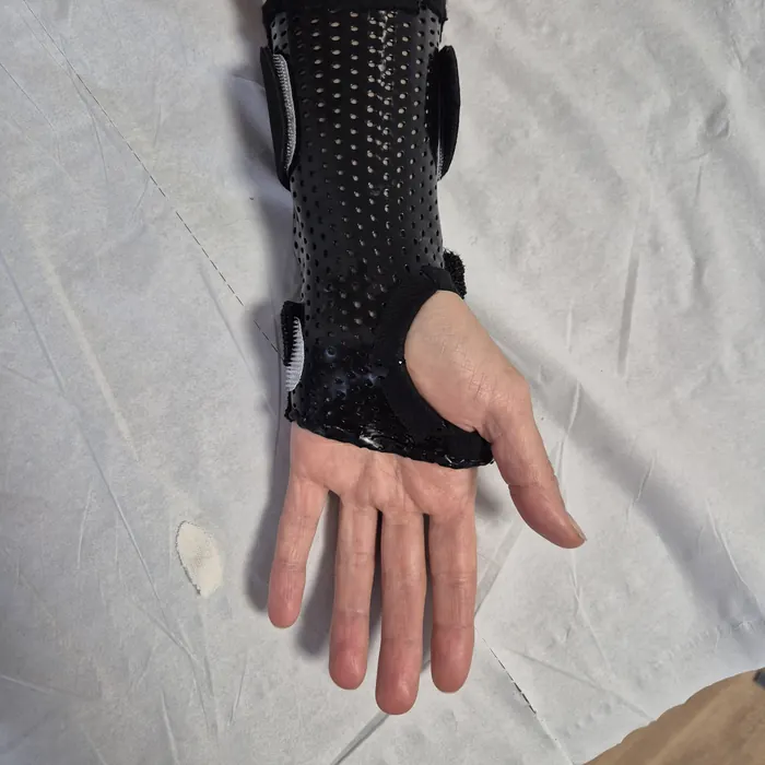 Orthèse de poignet sur mesure